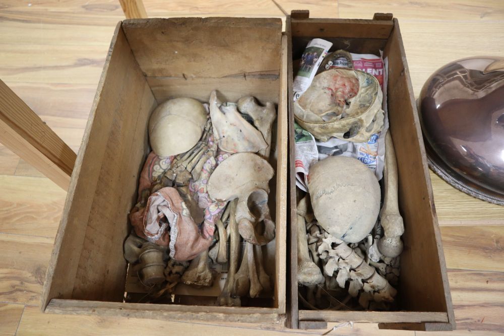 An early 20th century medical half skeleton with skull in H K Lewis & Co pine box and a part skeleton (no skull)